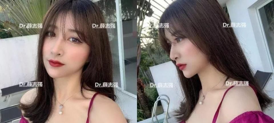  『后12小时内』假期术后注意事项大全！