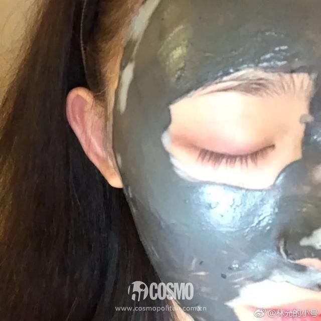  『皮肤』美人计 | 听说戴口罩之后就疯狂冒痘，我来给你诊断诊断