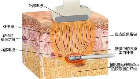  种方式■肯豆变芭比、麦粒成Cool girl，2020炫腹小“腰”精风正式上线