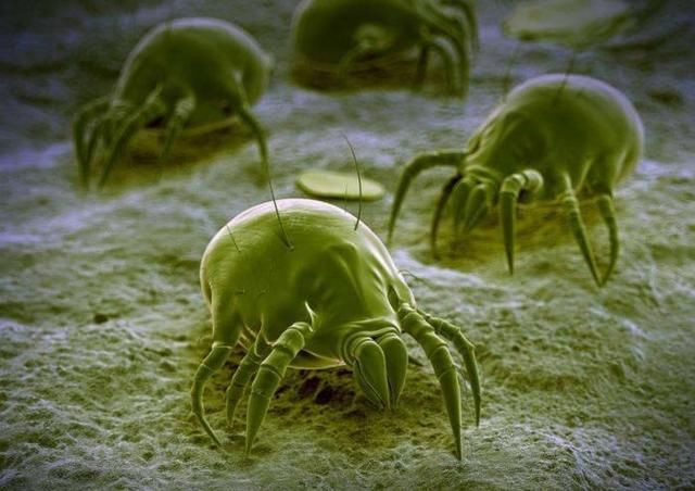 百万螨虫在后背“为非作歹”有4个表现，别太晚知道，教你3招灭螨