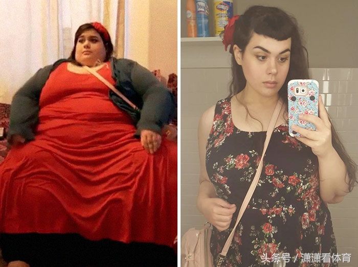 这群体重超过500斤的人仍回归正常,减肥堪比整容!