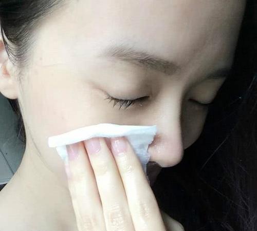 大妈巧用,三个祛斑小妙招,不反弹更年轻