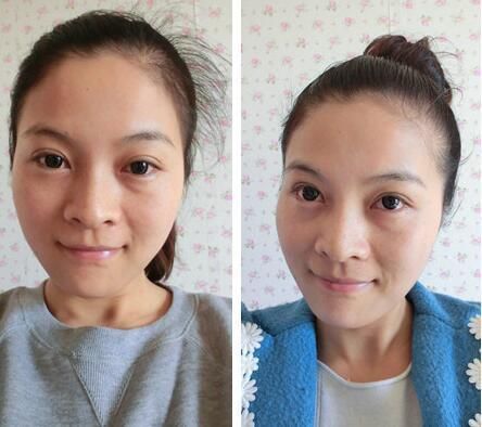 长斑无需慌张，祛斑没有那么难，每天睡前用它抹下脸，祛斑又美白