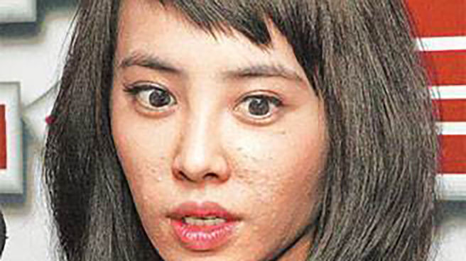 明星也会起痘痘，刘涛起痘后这样做，回到镜头下照样是女神!