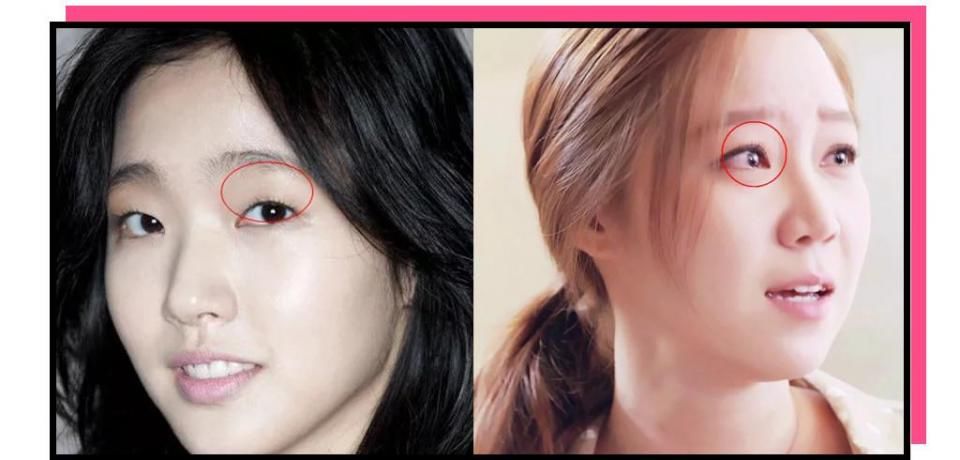 “你这个是肿眼泡，哭不出邓伦那样的双眼皮的。”