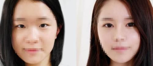 女生@被吓出一身冷汗,为何现在越来越少的女生割双眼皮?看到变化史后