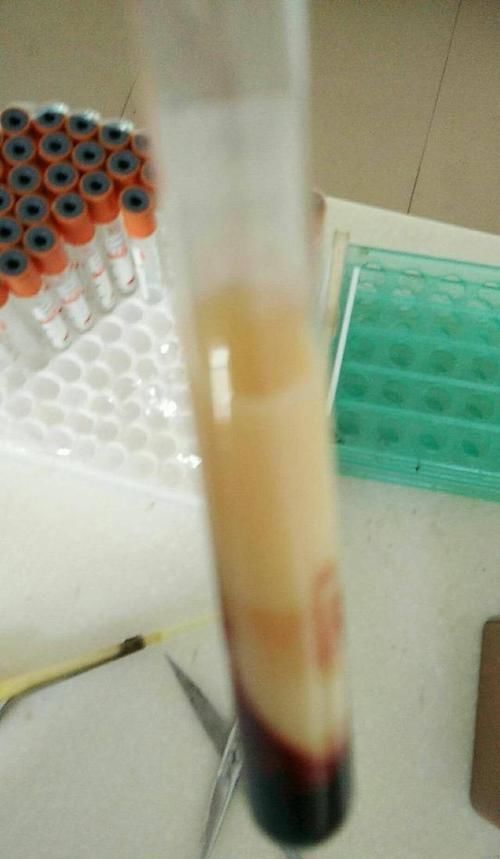  [血红蛋白]查血常规、尿常规、便常规的意义是什么？多久需要查一次？