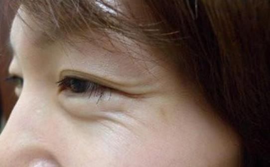  『女人』为什么女人会有“鱼尾纹”？学会3个小方法，还你完美肌肤