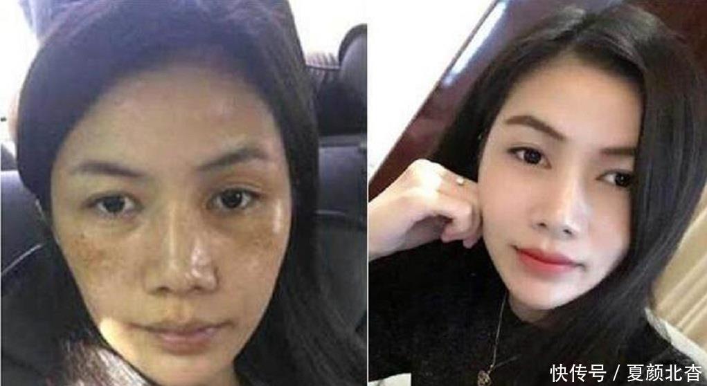 白淡斑■巧用白糖加“它”敷脸，不出半个月美白淡斑又亮肤，比面膜都好用