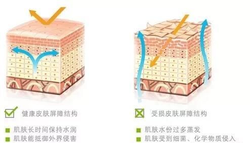 『过敏还』冬去春来，识别皮肤过敏源，皮肤“过敏”怎么急救？