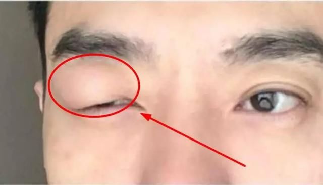 整个剧组全面停工,本以为是“明星耍大牌”,却仅仅是一只蚊子!