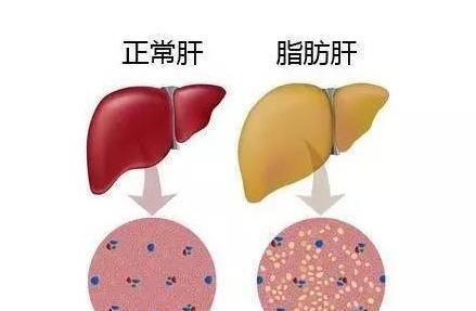  「食物」抽烟伤肺、喝酒伤肝,喝酒前吃4类食物,可以减少酒精对肝脏伤害...