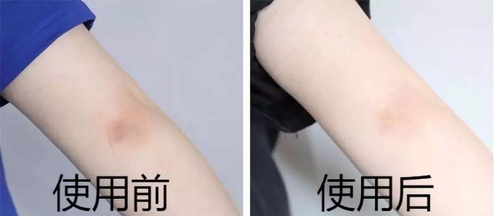 女人身上最需要保养的部位，90%女人竟都忽略了