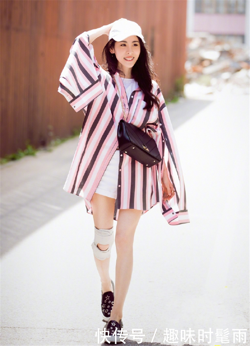 路遇张碧晨，在无美颜的镜头下这腿吓到我了，网友：穿上裤子吧！