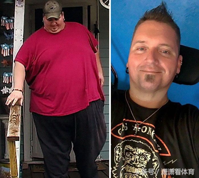 这群体重超过500斤的人仍回归正常，减肥堪比整容!