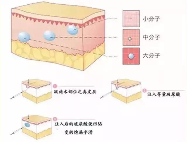 这是目前最流行的斩男脸TOP3，来看看自己属于哪种脸型