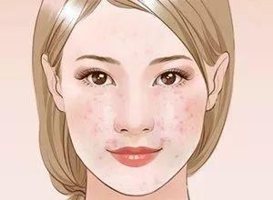  #护肤品的时#皮肤越来越差，背后的元凶竟然是这6点原因