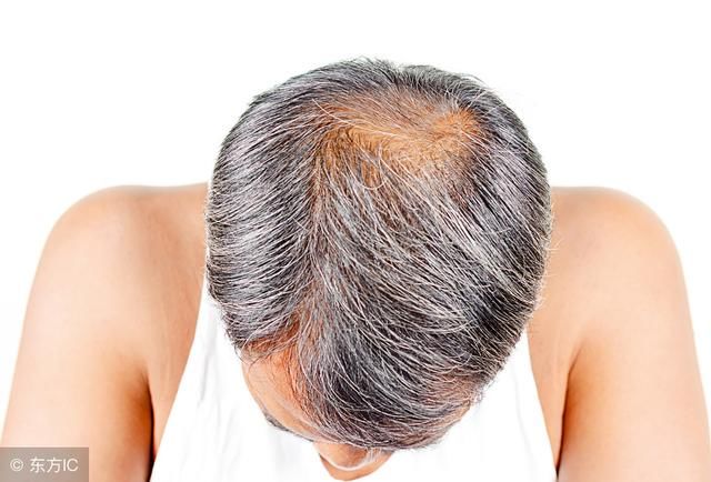 警惕:脸上一旦出现这3种信号，说明螨虫已经“覆盖”成虫海了!