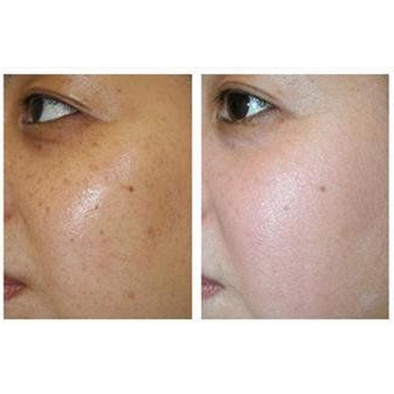 女人脸上的4个“特征”，有两个就是天生美女，出门素颜不用化妆