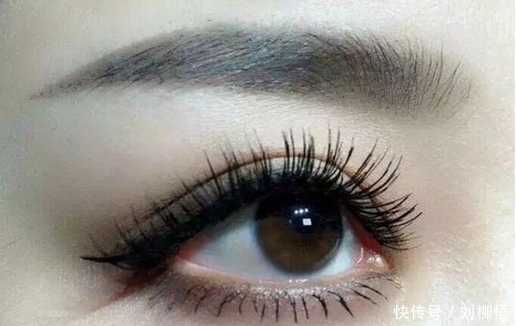 「爱美人士」单眼皮做双眼皮好多钱