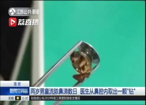  鼻腔@当心异物！淮安一两岁男童流脓鼻涕数日 医生从鼻腔内取出