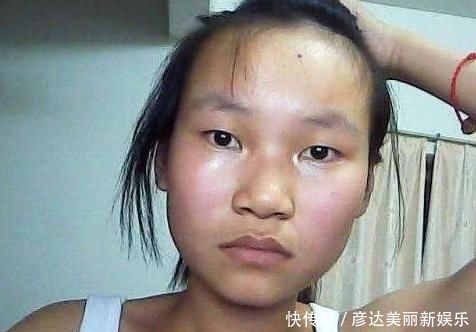 『脸上』青春期女生脸上总“出油”?坚持3个好习惯,对“大油田”说拜拜