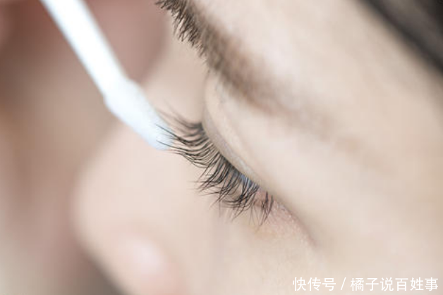 时间:为了一双大眼睛,去“种睫毛”值不值最好提前了解这些隐患!