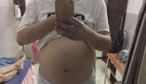  【不起】胎儿留级，很多孕妇还不知其因，这个锅胎儿背不起！