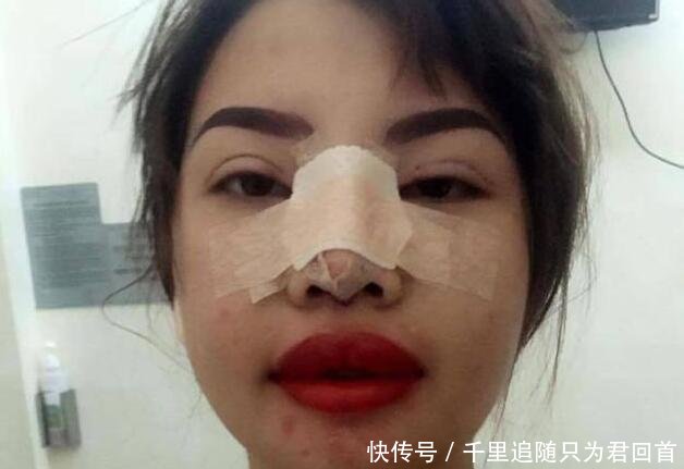 漂亮：从丑女变成漂亮女神，嫁给了富二代，21岁丑女花费10万元整容