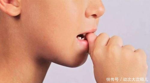 坦言■自小爱啃指甲的孩子,长大后会怎样医生坦言一般都是两种结局