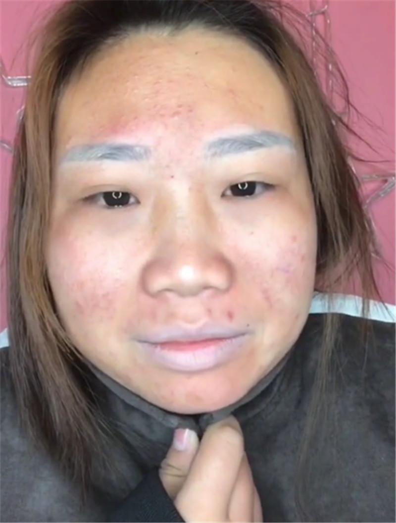 女子太丑总被丈夫嘲笑 整容后成直播间女神