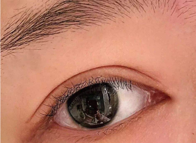 天然双眼皮和割出来的双眼皮，究竟区别在哪？涨知识了！