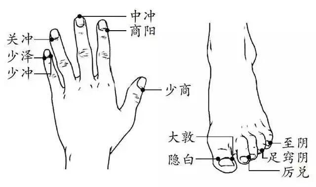 中医学子妙用针灸救人命,三棱针放血治疗