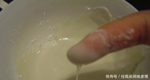 # 黑头#黑头乖乖跑出来，鼻子挤出来的“黄色条物”是啥协和医生教你3招