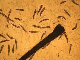 睡醒后出现4迹象, 不要怀疑, 说明毛孔已被螨虫堵得水泄不通