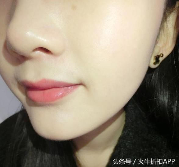 药店“2元钱”药片，睡觉擦一点，皮肤越擦越白，遗憾知道的太少