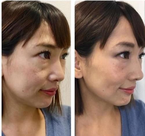  【化妆能】老妈妆发｜用普通人的对比照片告诉你，年纪越大越要化点妆！