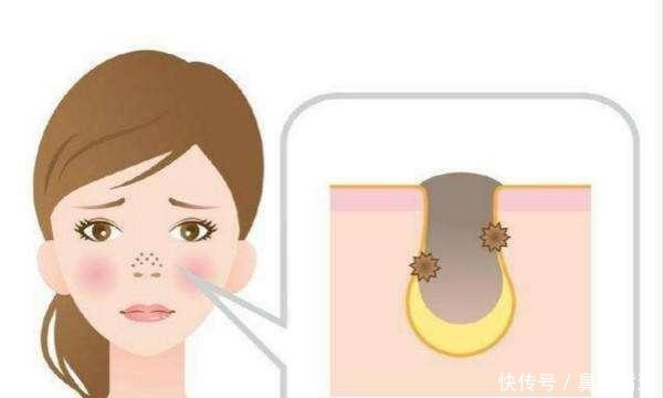 毛孔粗大@想要收缩毛孔其实不难,难的是你没法坚持着7点,别不服气