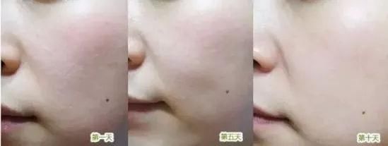 妮姿颜：轻熟龄肌保养有道，素颜女神宋智孝有话要说！