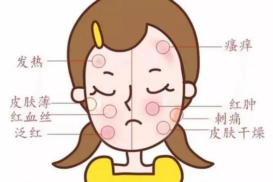  「过敏」断货王 | 柳絮敏感期50天 美少女可不能“脸红”50天啊