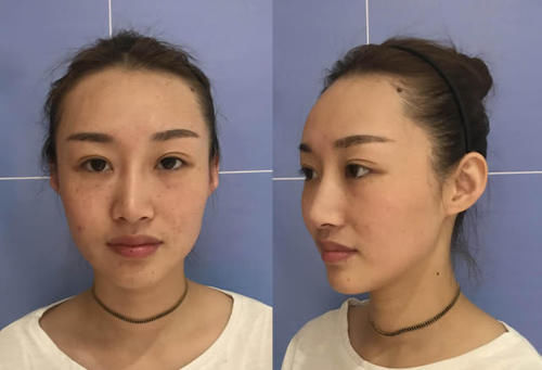  「恢复」30＋女生皮肤变松垮，怎样才能恢复到18岁的紧致脸？