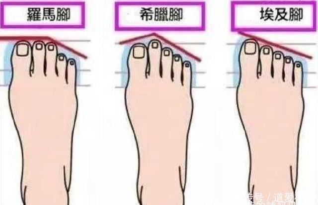  「罗马脚」你的脚型穿对了鞋吗？希腊脚是公认的美女脚，很多人是埃及脚