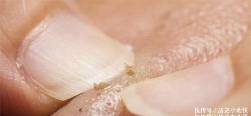 『洗面奶』体验: 香皂洗脸和洗面奶洗脸, 2个月后, 结局大不同!