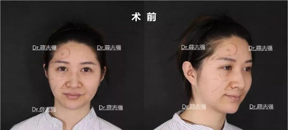 『后12小时内』假期术后注意事项大全！