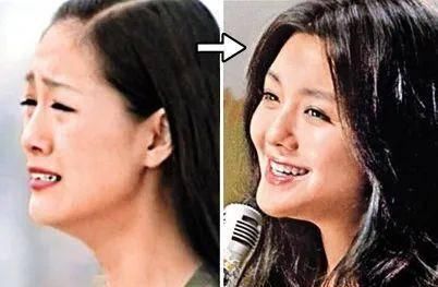  「看起来就」为什么做了整形也没有变好看