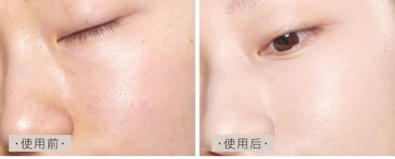 用它洗脸，面膜钱都省了，越洗越白净，洗完就能素颜出门