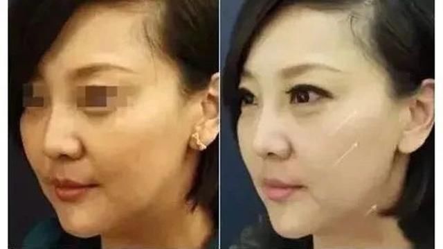 假唱假摔见怪不怪,揭秘娱乐圈的"造假"事件!就连票房