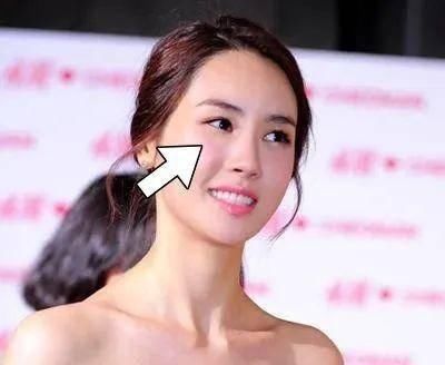  「看起来就」为什么做了整形也没有变好看