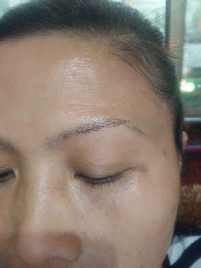 冒出“老年斑”不用害怕，教你1个土法，抹5次斑如雨下