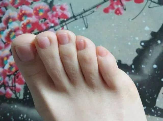  『始衰老』女人老不老，看脚就知道？若脚上没有3个表现，恭喜你还年轻！